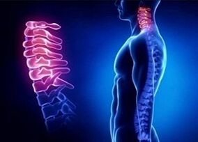 Gimdos kaklelio osteochondrozės vystymosi priežastys