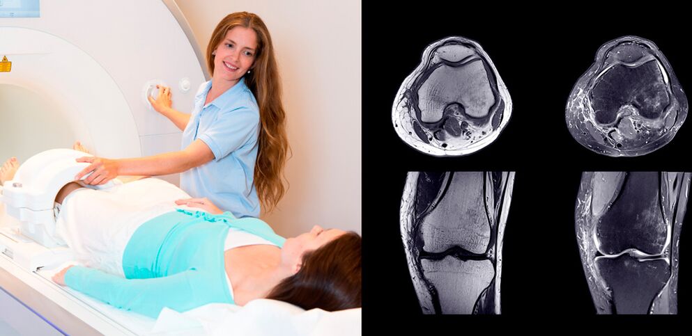 kelio sąnario diagnostika