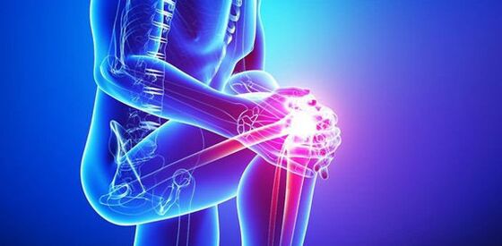 stiprus skausmas kelio sąnaryje